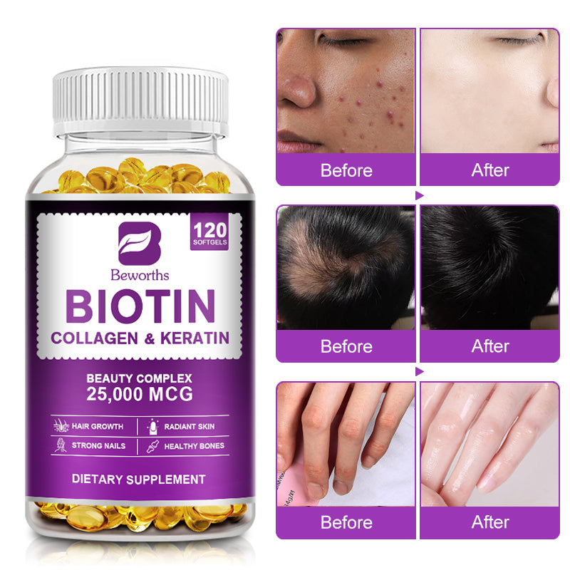 Beauty Complex Biotin Capsules with Collagen & Keratin
