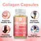 Multi Collagen Capsules | Hydrolyzed Collagen Type I, II, III, V, X | Hair, Skin, Nail & Joint Support, 120 Capsules
