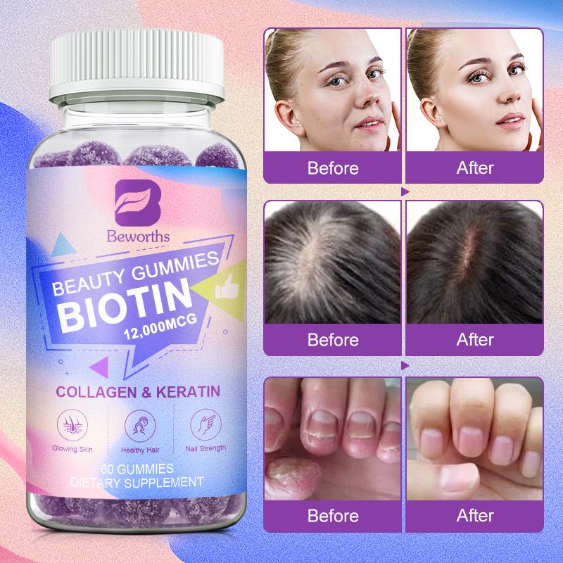 BEWORTHS Biotin Gummies 12000mcg with Biotin, Collagen, Keratin, Chlorophyll, Zinc and Vitamin A, B6, B12, C, D, E Complex